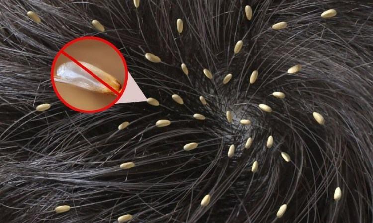 Mơ Thấy Con Chấy Có Ý Nghĩa Gì?